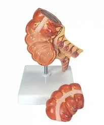 Caecum and Appendix, Enlarged