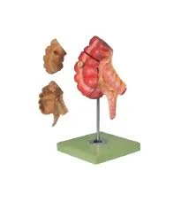 Appendix and Caecum