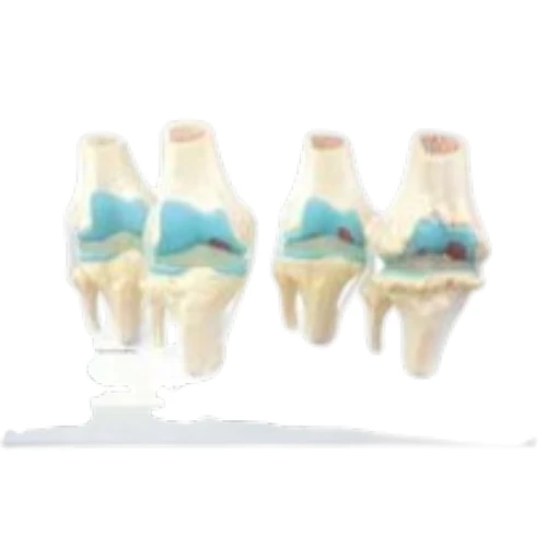 Knee Arthritis Model