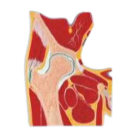 Hip joint Section Model