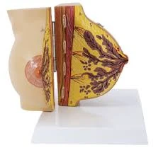 Female Breast Model Dx. During Lactation