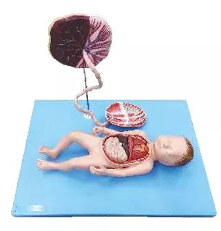 Full Term Fetus with Viscera and Placenta
