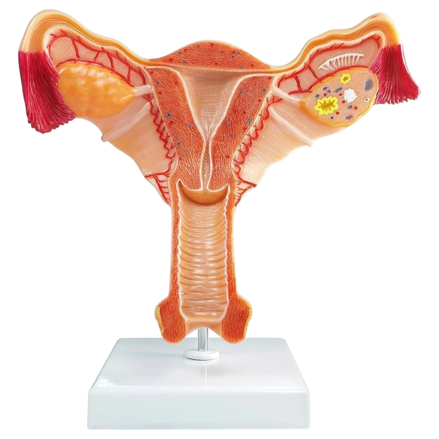 Female Uterus Ovary Model