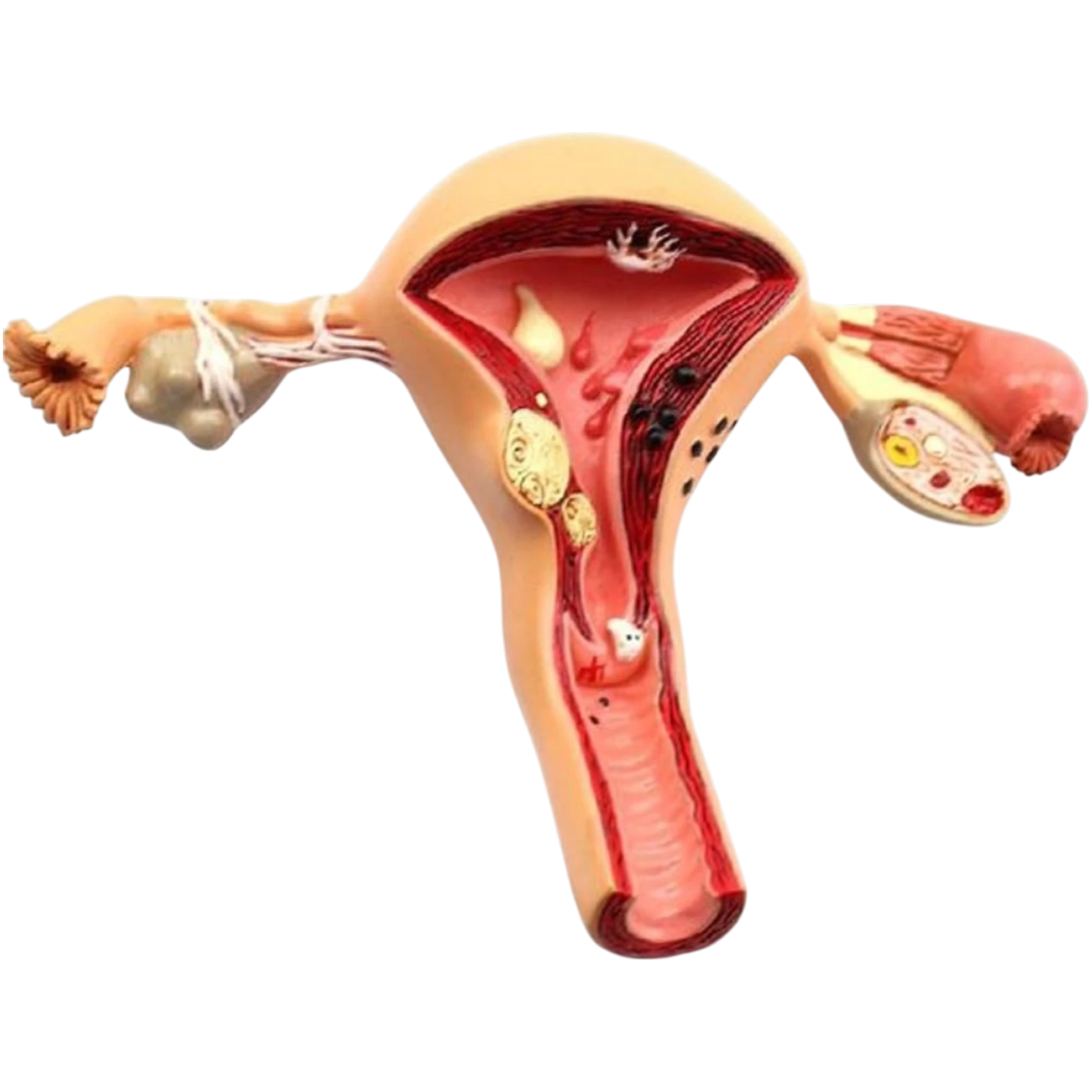 Uterus & Ovary Pathologies Model