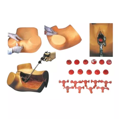 GD/F30S Gynaecological Examination Model