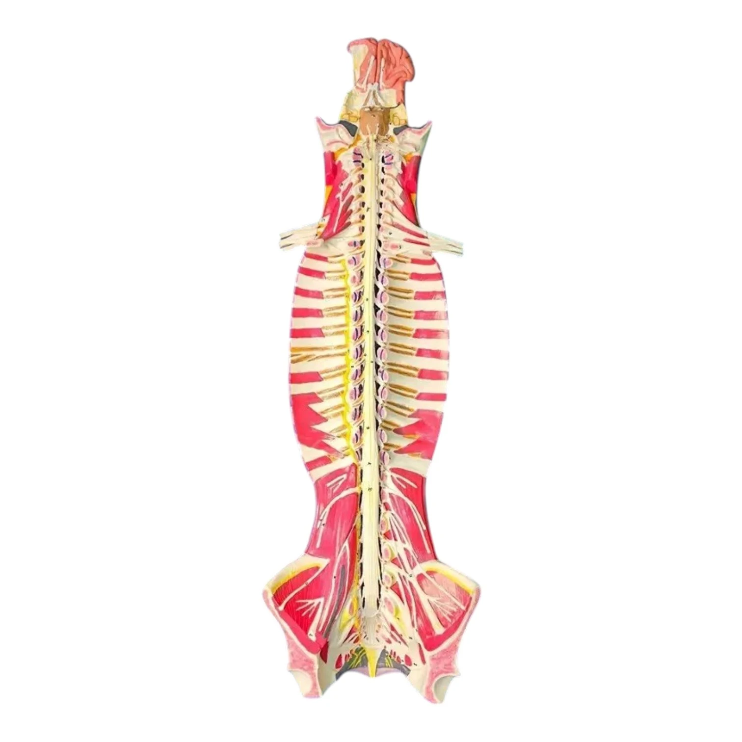 Spinal Cord in the Spinal Canal