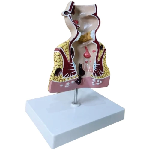 Rectum Pathologies Model