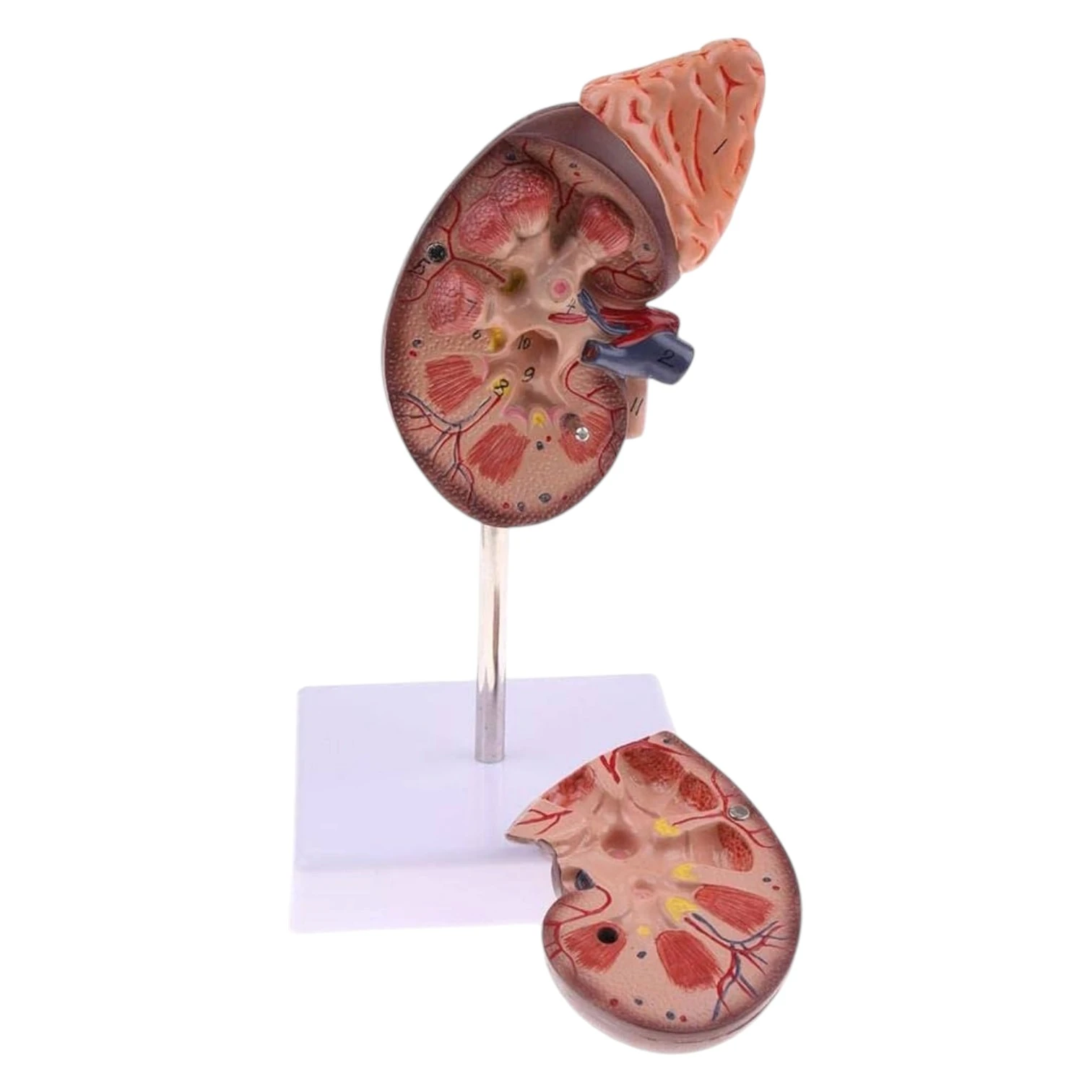 Kidney with Adrenal Gland, 2 Parts